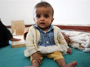 “Children in Yemen are suffering the devastating consequences of a war that is not of their making" (AFP/File)