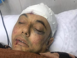 مصادر طبية: وضع أبو سيف خطير، وأنه يخضع لفحوصات طبية وصور طبقية في رأسه 