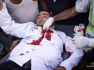 عشرات الإصابات بالرصاص الحي شرق قطاع غزة
