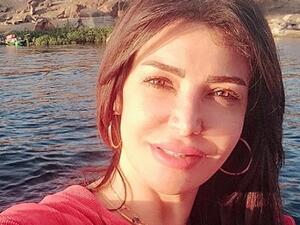 لقاء سويدان ترد على منتقدي (ملامحها المنفوخة)!