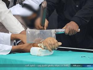 It is not known if the man being punished is a member ISIS or if he is simply subjected to the harsh Sharia law the terrorists practice.