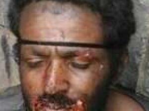 مصاص دماء الكلاب