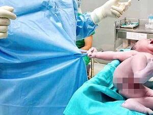 This is the adorable moment a newborn baby boy grabs hold of a doctor's shirt and refuses to let go after just being born (dailymail.co.uk)