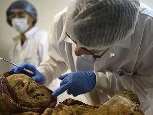 Dr Charlier studied the mummy for two days. He took samples of bone and dry tissue for genetic analysis and carbon 14, or radiocarbon which would provide more indications to the genesis of the disease (AFP)