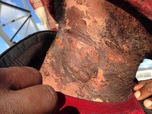 There have been nearly 1,000 human rights violations by French police (Twitter)