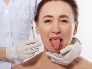 هناك أمكانية أخرى تسبب الطعم الحامض في الفم وهي الاضطرابات العصبية