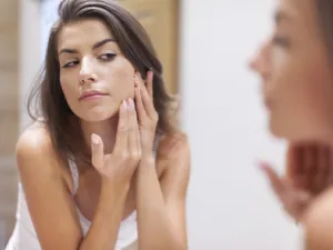 هنالك أسباب لظهور حب الشباب أهمها العوامل الميكروبية والوراثية والهرمونية