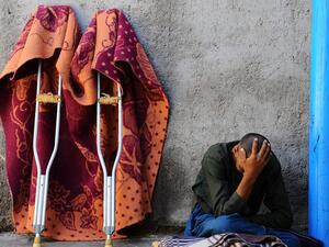 An Afghan patient sits in a yard at the only mental health rehabilitation center in the city of Herat in April 2014.
(AFP/ File Photo)