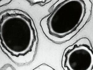 A microscopic view of anthrax spores. Photograph (AFP)