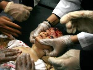 طفل قتل برصاص قناصة النظام في اليمن. طفل قتل برصاص قناصة النظام في اليمن.