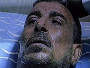 صورة للمواطن المصري الذي أحرق نفسه أمام مجلس الشعب المصري.