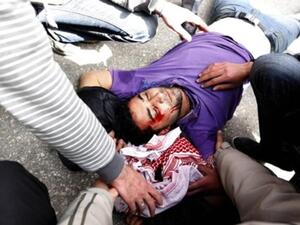 أحد المصابين بحجارة البلطجيه في يوم جمعة 25 آذار في العاصمة الأردنية عمان. أحد المصابين بحجارة البلطجيه في يوم جمعة 25 آذار في العاصمة الأردنية عمان.