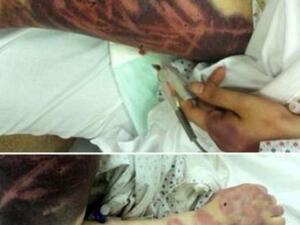 امرأة سعودية ضربها زوجها بالمفك! امرأة سعودية ضربها زوجها بالمفك!