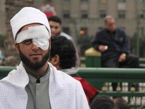 جمعة العين الواحدة في مصر. جمعة العين الواحدة في مصر.