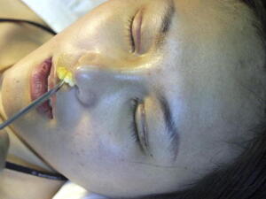 عمليات التجميل منتشرة جدا في لبنان. عمليات التجميل منتشرة جدا في لبنان.