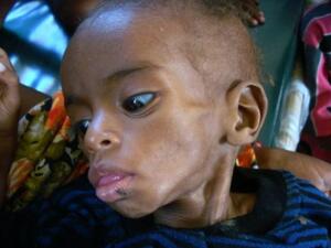 الإنسان هو السبب الأول لجوع أخيه الإنسان. الإنسان هو السبب الأول لجوع أخيه الإنسان.