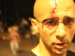 أحد المصابين في الاصطدامات بين المتظاهرين وقوات الأمن في ميدان التحرير المصري ليلة أمس. أحد المصابين في الاصطدامات بين المتظاهرين وقوات الأمن في ميدان التحرير المصري ليلة أمس.