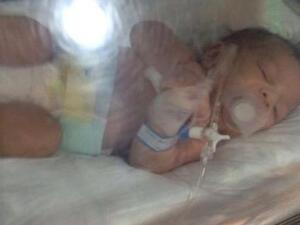 ممرضات يغلقن فم رضيع بشريط لاصق