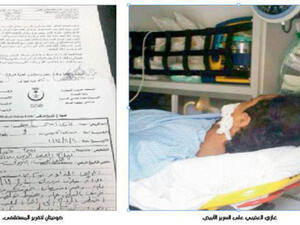 سرقة كلية مواطن سعودي في مستشفى حكومي