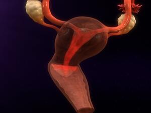 عندما يكون هُناك جرح في المثانة يجب تحويل المريضة إلى المشفى

