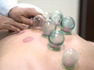 الحجامة وسع الأوعية الدموية، وهذا يؤدي إلى انخفاض ضغط الدم