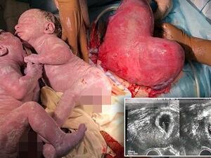 Heart-shaped womb (Twitter)