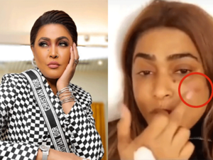 Waad was in a very bad psychological state after she discovered the results of a recent plastic surgery she had (Source: sana alsaid - Youtube - waedhanan - Instagram) Waad was in a very bad psychological state after she discovered the results of a recent plastic surgery she had (Source: sana alsaid - Youtube - waedhanan - Instagram)