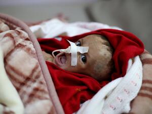 Cholera cases tripled in Hodeidah, Yemen (Twitter)