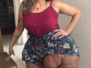 Karina Rodini with huge tumours (Twitter)