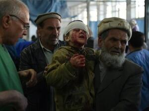 افغاني يحمل طفلا أصيب بحروح في انفجار سيارة مفخخة قرب المبنى السابق لوزارة الداخلية، في مستشفى في كابول

