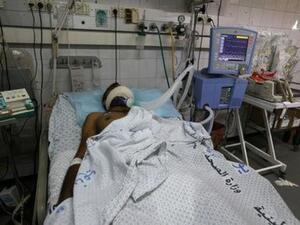 أحد المتظاهرين في الثالثة والعشرين من عمره وضع على أجهزة الإعاشة في مستشفى في غزة بعد أن اخترقت عبوة مسيلة للدموع وجهه في احتجاجات على الحدود مع إسرائيل يوم الجمعة


