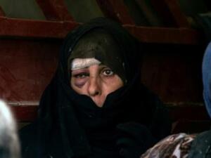 امرأة عراقية فرت من القتال الدائر بين القوات الحكومية ومن تبقى من الجهاديين في المدينة القديمة في الموصل تنتظر نقلها إلى مأوى

