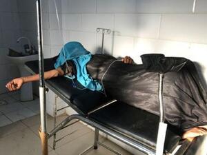 امرأة من النازحين في مستشفى المخا باليمن
