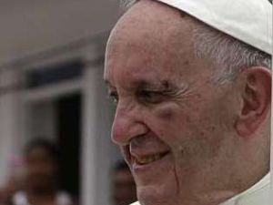 البابا فرنسيس يصاب بوجهه اثر اصطدامه بزجاج سيارته 