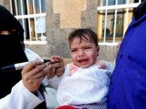 حملة تلقيح للأطفال في العاصمة صنعاء

