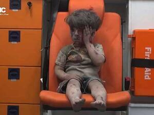 الطفل السوري عمران