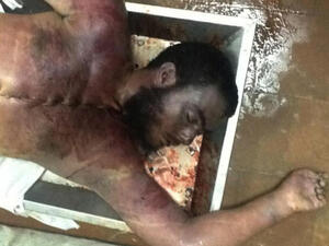 احد قتلى الحادث-صورة عن الانترنت