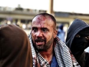 متظاهر جريح في تضارب بين مؤيدي ومعارضي الرئيس مرسي/أ.ف.ب