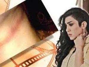 Fatima Abdel Rehim is alive to act another day after brush with death