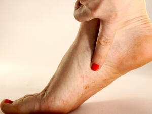 أكثر أنواع الفطر شيوعًاً هو فطر الأظافر أو ما بين الأصابع 