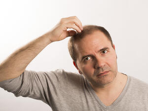 زراعة الشعر أفضل الاقتراحات المتاحة أمام من يريد التخلص من مشاكل الشعر 