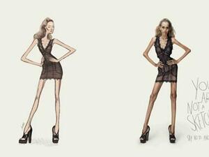 اعلان وكالة ستار موديلز المناهض لانروكسيا عارضات الازياء