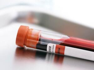 استشارة الطبيب الفورية أمر ضروري 