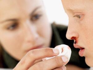 ما هو نزيف الأنف الربيعي؟