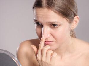 هل تعانين من مشكلة الرؤوس السوداء؟