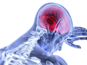 9 حالات من كل 10 من مرضى السكتة الدماغية تكون الجلطة هي السبب