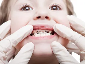 الوقاية خير من العلاج