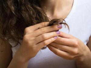 بعض المرضى يعانون من وسواس قهري يجبرهم على سحب خصل الشعر والتهامها