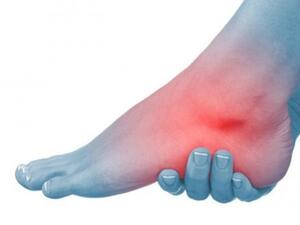 التورم قد يكون ناجما عن طريقة الجلوس الخاطئة