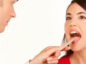 لسانك يحمل اسرار عن صحتك